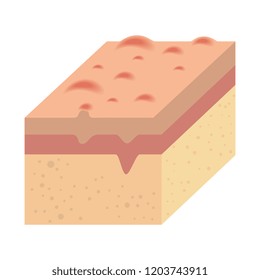 layer of skin type