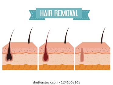 layers skin structure with hair removal icons