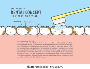 Layout Brushing very dirty teeth cartoon style for info or book illustration vector. Dental concept.