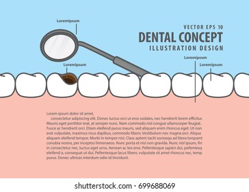 Layout decay tooth check up (Cavity) cartoon style for info or book illustration vector. Dental concept.