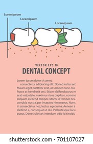 Layout Food stuck in teeth frame cartoon style for info or book illustration vector on blue background. Dental concept.