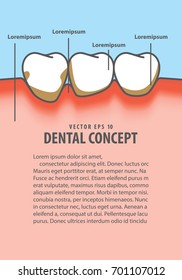 Layout Human gum inflammation frame cartoon style for info or book illustration vector on blue background. Dental concept.