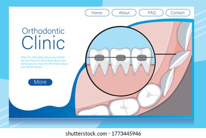 Layout for orthodontic services website with teeth and braces. Molars and incisors top view. Vector stock illustration with layout or website template for landing page.