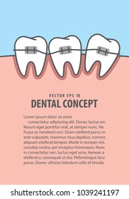 Layout Orthodontic teeth braces illustration vector on blue background. Dental concept.