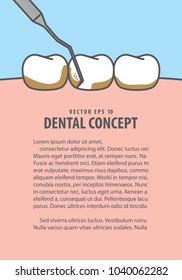 Layout Scaling teeth illustration vector on blue background. Dental concept.