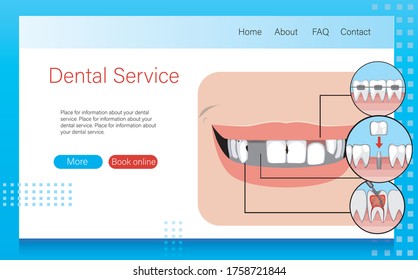 Layout or template for the Internet with a smile and teeth for an orthodontic or dental. Flat vector stock illustration with braces, caries and dental miplant as a layout for a website or landing