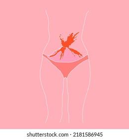 folleto sobre menstruación. La menstruación causa malestar y posible dolor. Es normal ser una mujer con cicatrices y crecimientos en el cuerpo. Vector.