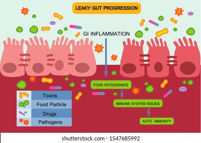 Leaky Gut Syndrome or Intestinal Permeability Diagram