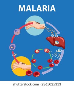 Aprenda sobre las etapas de la transmisión de parásitos de la malaria a través de una infografía atractiva