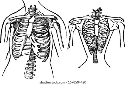 The left figure represents the natural shape of the chest, and that upon the right, the contracted state of it, owing to tight lacing, vintage line drawing or engraving illustration.