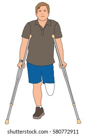 Left leg amputee is walking with the aid of crutches