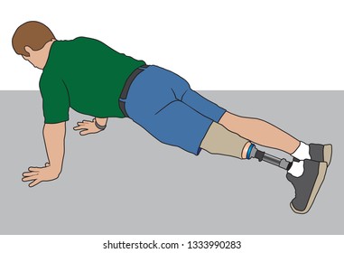 A Left Leg Below Knee Amputee Is Exercising By Doing Pushups