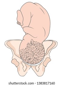 Left Occiput Anterior LOA Baby Fetal Position Pelvis  ROA Right