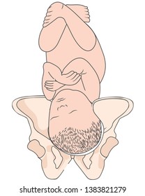 Left Occiput Posterior LOP Baby Fetal Position Pelvis - ROP Right