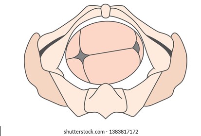 Left Occiput Transverse w LOT Baby Fetal Position Pelvis ROT Right