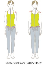 Distorsión izquierda y derecha de la columna vertebral y pelvis, ilustración de una mujer recta