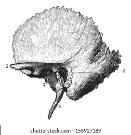 Left temporal bone, vintage engraved illustration. Usual Medicine Dictionary by Dr Labarthe - 1885.