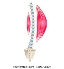 Left-sided scoliosis. Levoscoliosis. Muscles and spine. Spinal curvature in scoliosis. Infographics. Vector illustration on isolated background.