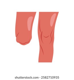 Leg Amputated, Disability Vector Illustration Isolated