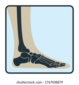 Leg-Knochen, Röntgen-Concept-Ikone, menschliches Körperbild von Röntgen einzeln auf Weiß, flache Vektorgrafik. Skelett Teil des menschlichen Organismus, Silhouette schwarze biologische Wissenschaft.