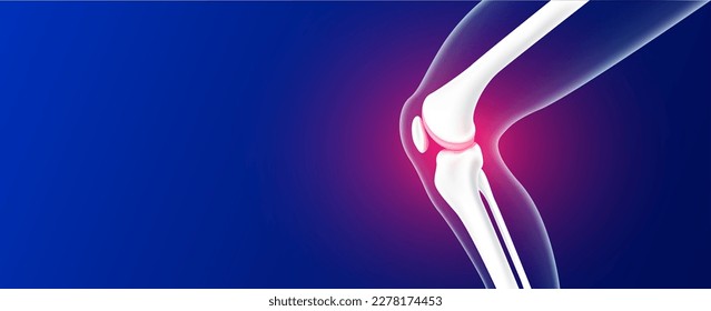 Leg bones   knee joint cartilage inflammation blue background and copy space for text  Human skeleton anatomy  Medical health care science concept  Realistic 3D vector 