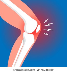 Inflamación del cartílago articular de la rodilla y huesos de la pierna sobre fondo azul Anatomía esquelética humana. Vector científico de atención médica