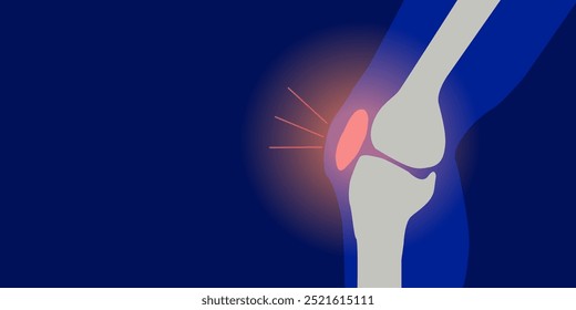 Inflamação dos ossos da perna e da cartilagem da articulação do joelho sobre fundo azul. Anatomia do esqueleto humano. Conceito de ciência médica. ilustração da dor no joelho.