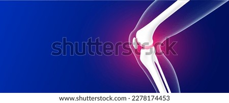 Leg bones and knee joint cartilage inflammation on blue background with copy space for text. Human skeleton anatomy. Medical health care science concept. Realistic 3D vector.