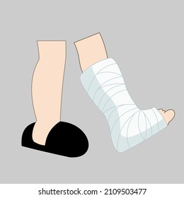 leg in a cast or bandage. vector illustration