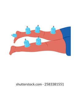 Leg Cupping, Therapy flat vector illustration isolated