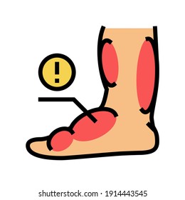 leg edema critical leg health problem color icon vector. leg edema critical leg health problem sign. isolated symbol illustration