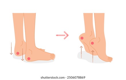 Leg edema exercise – calf stretch to reduce swelling and improve circulation in women