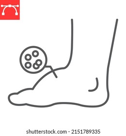 Leg Edema Line Icon, Diabetic And Foot, Leg Swelling Vector Icon, Vector Graphics, Editable Stroke Outline Sign, Eps 10.