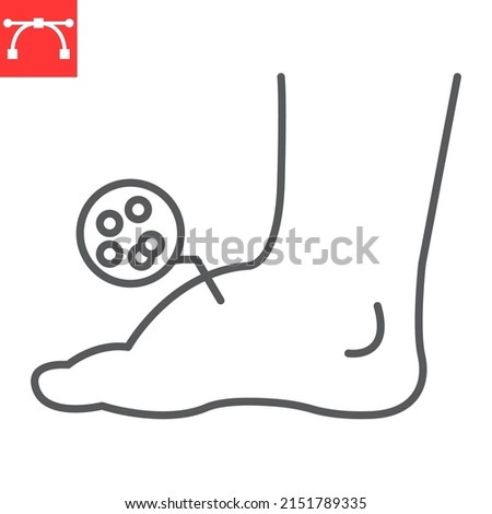 Leg edema line icon, diabetic and foot, leg swelling vector icon, vector graphics, editable stroke outline sign, eps 10. Foto d'archivio © 