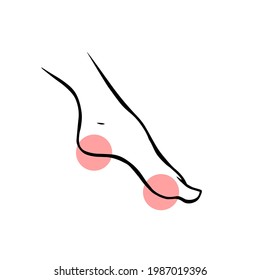 Leg with heel pain. Orthopedic disease plantar fasciitis. Vector isolated outline illustration