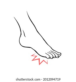 Pierna con dolor de tacón. Enfermedad ortopédica. Problemas de salud de los pies. Dibujo manual de la ilustración de contorno aislado del vector