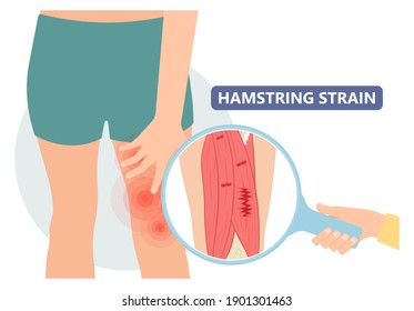 Hamstring Dolor muscular de herida en la cepa del muslo 