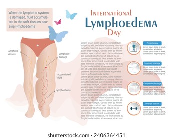 Leg with lymphedema and some of the treatments for improvement, along with space for text.