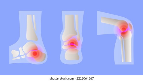  	
Leg Pain Design Background With Medical Technology Illustration.