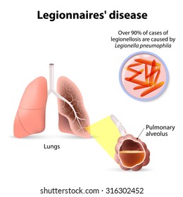 Legionnaires' disease or legionellosis, Legionella pneumophila