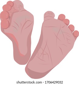 
legs of a newborn baby