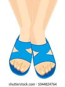 Legs in schist