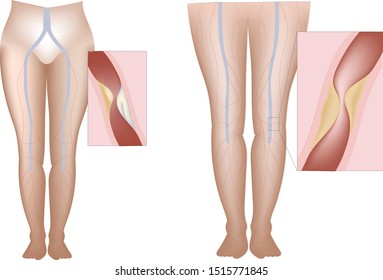 legs/anatomical drawing / internal organs