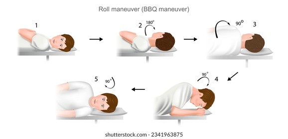 Lempert roll maneuver BBQ a practical guide to the treatment of benign positional paroxysmal vertigo (bppv). Training manual, education. Vector. 