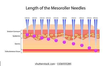 Length of the mesoroller needles, Vector illustration