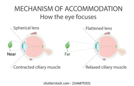 Lens accommodation mechanism. Anatomy of the eyeball. Projection of the image in the eye. Vector graphic illustration.