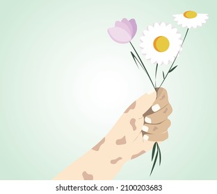 Leper hand holding flowers. Leprosy Day Symbol for Social Media Template Banner with copy space for text. Vector illustration of a background or poster for World Leprosy Day.