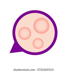 Concepto de enfermedad de la lepra. Ilustración vectorial