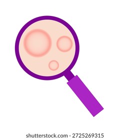 Concepto de enfermedad de la lepra. Ilustración vectorial