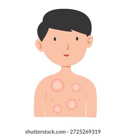 Concepto de enfermedad de la lepra. Ilustración vectorial